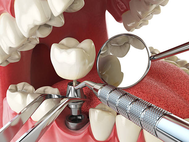 Best Emergency Treatment for Jaw Pain or Injury in Huachuca City, AZ